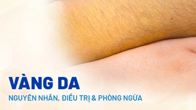 Da vàng có bị sao không?