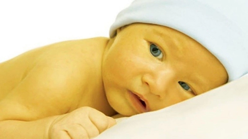 Phương pháp và mẹo chữa trị khi bị da vàng