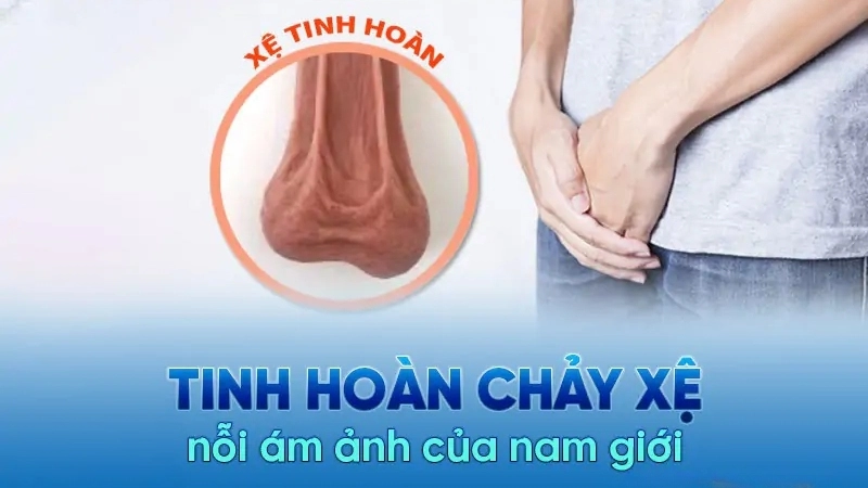 Dái xệ có bị sao không?