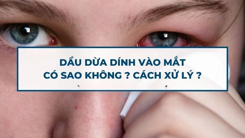 Dầu dừa vào mắt có bị sao không?