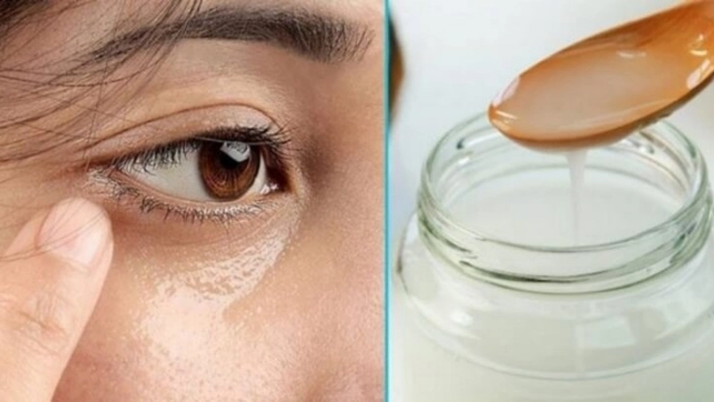 Dấu hiệu nhận biết khi bị dầu dừa vào mắt