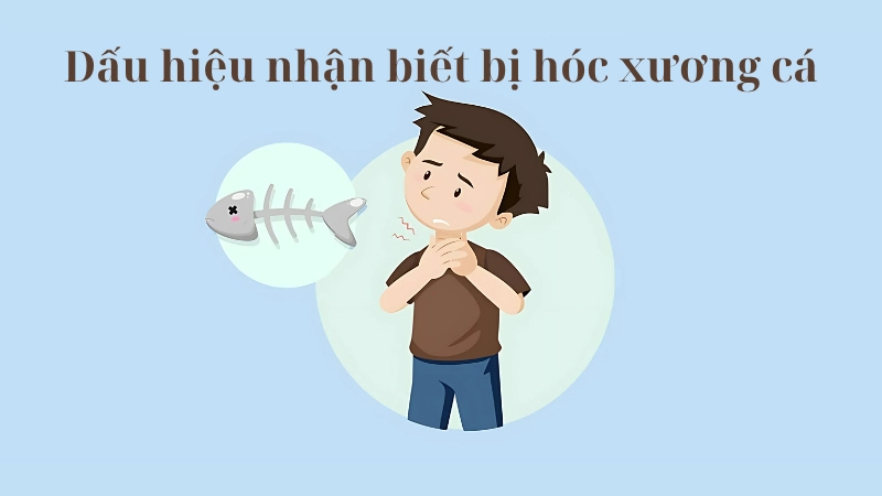 Dấu hiệu nhận biết bị hóc xương cá