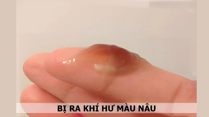 Dịch màu nâu có bị sao không?
