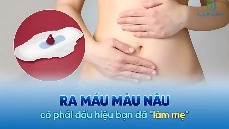 Triệu chứng khi bị ra dịch màu nâu