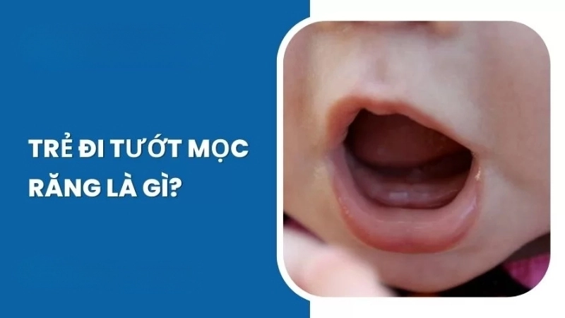 Em bé bị tướt có sao không?
