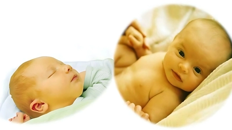 Triệu chứng khi bị vàng da