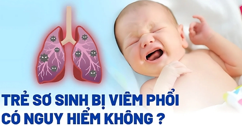 Em bé bị viêm phổi có sao không?