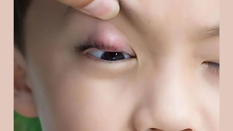 Khi nào thì bạn nên đi gặp bác sĩ