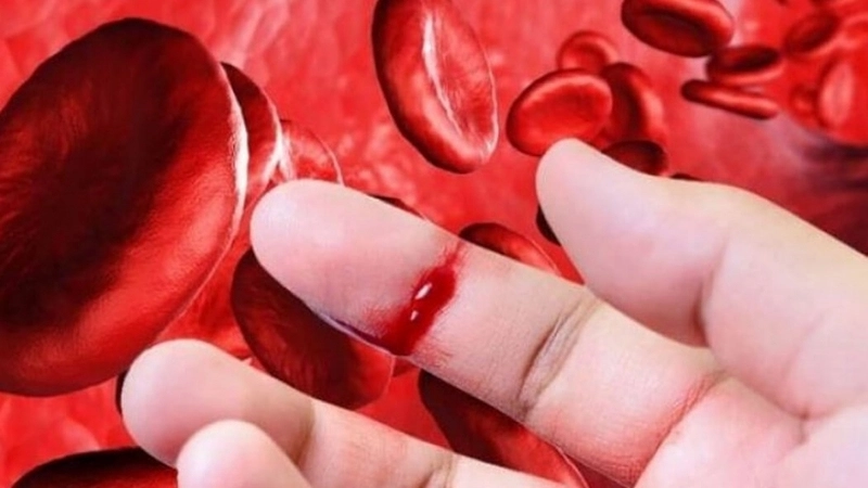 Dấu hiệu nhận biết khi bị loãng máu