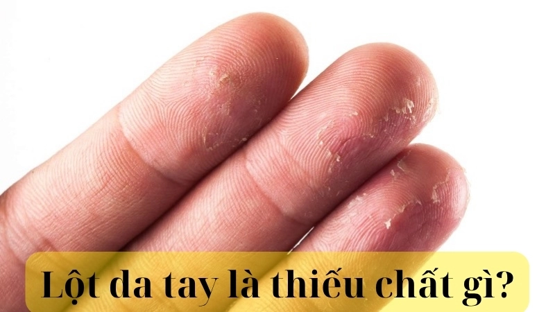 Lột da tay là thiếu chất gì?