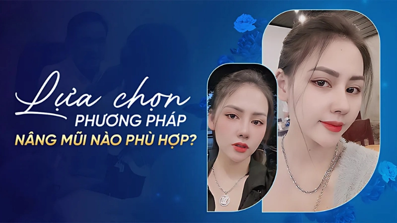  Lựa chọn phương pháp nâng mũi phù hợp
