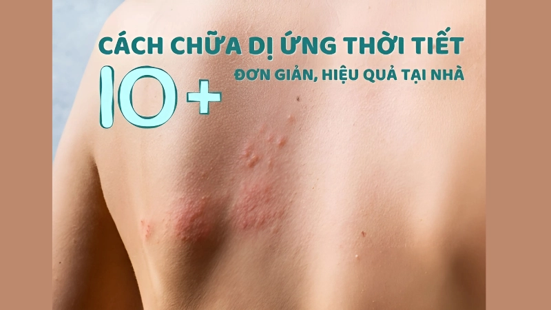 Mẹo chữa bệnh ngoài da, dị ứng nhẹ