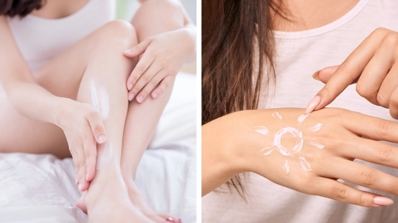 Một tuýp kem bôi da dị ứng thời tiết, gợi ý về phương pháp điều trị tại chỗ