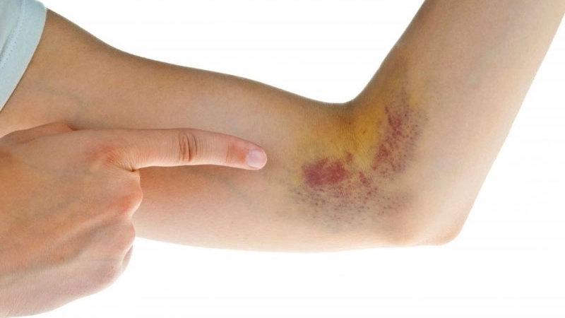 Cơ thể cần vi chất để bảo vệ thành mạch máu