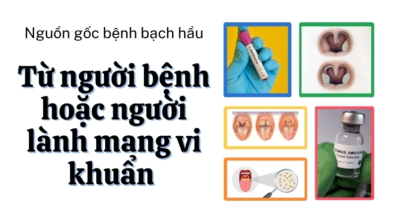 Nguồn gốc bệnh bạch hầu có thể từ người bệnh hoặc người lành mang vi khuẩn 