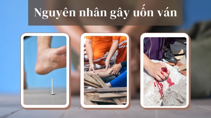  Nguyên nhân uốn ván chủ yếu do vi khuẩn xâm nhập qua vết thương hở, đặc biệt là vết thương bẩn