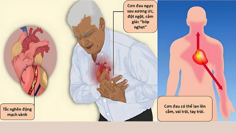Nhói tim có bị sao không?