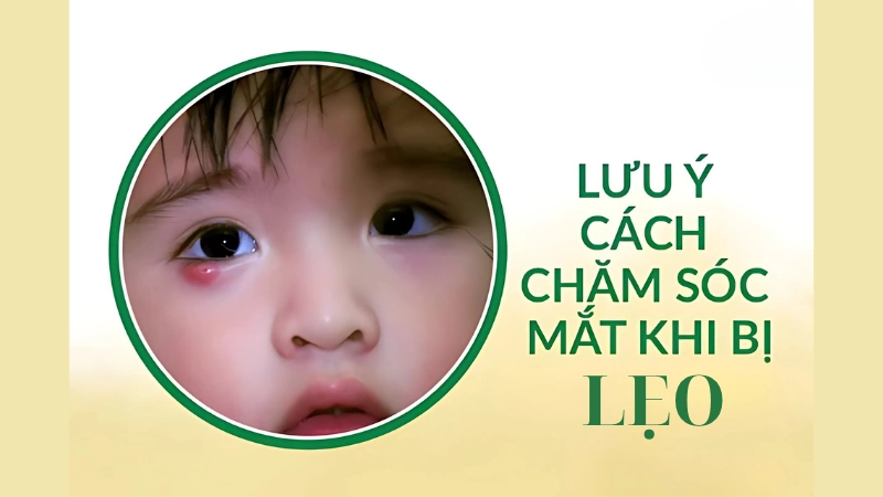 Những điều nên tránh khi bị lẹo mắt