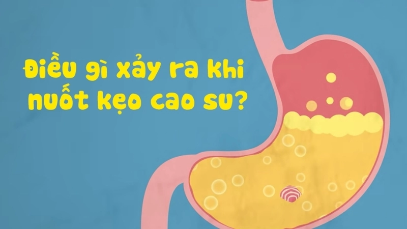 Mẹo và biện pháp chữa trị khi bị nuốt singum