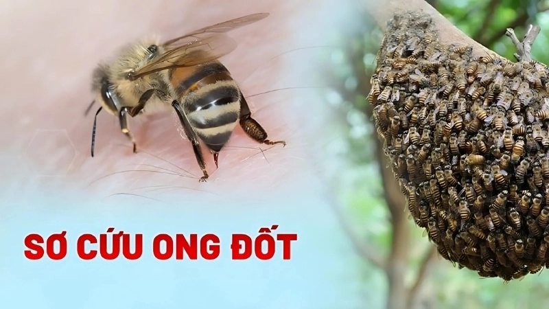 Phương pháp và mẹo chữa trị khi bị ong đốt