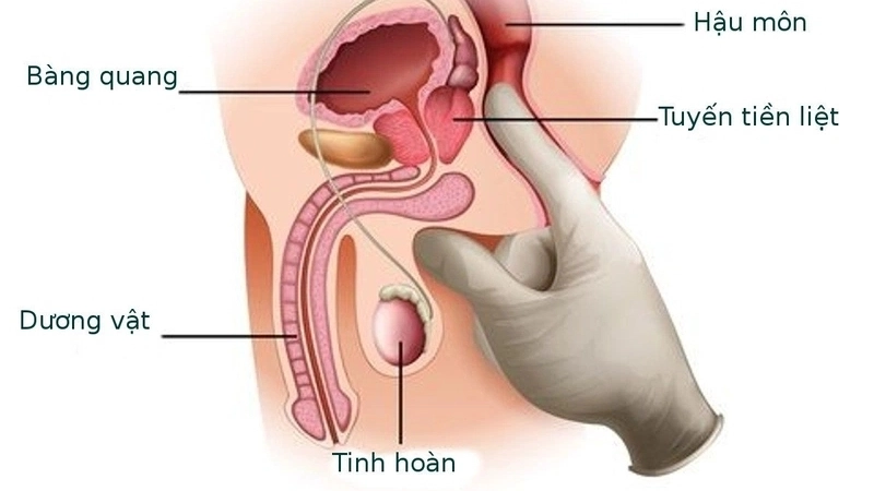 Quan hệ cửa sau có bị sao không?