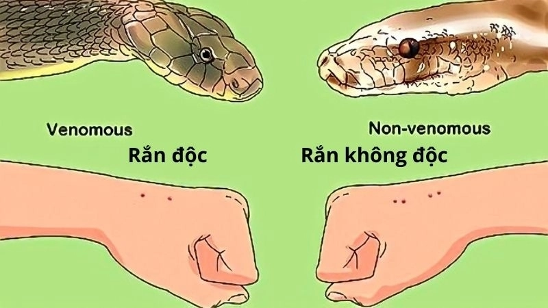 Dấu hiệu nhận biết khi bị rắn nước cắn