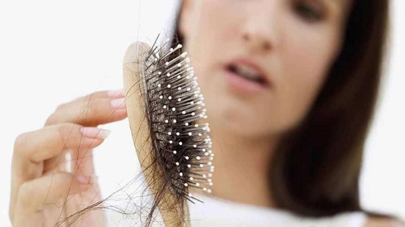 Triệu chứng, dấu hiệu nhận biết khi bị rụng tóc nhiều