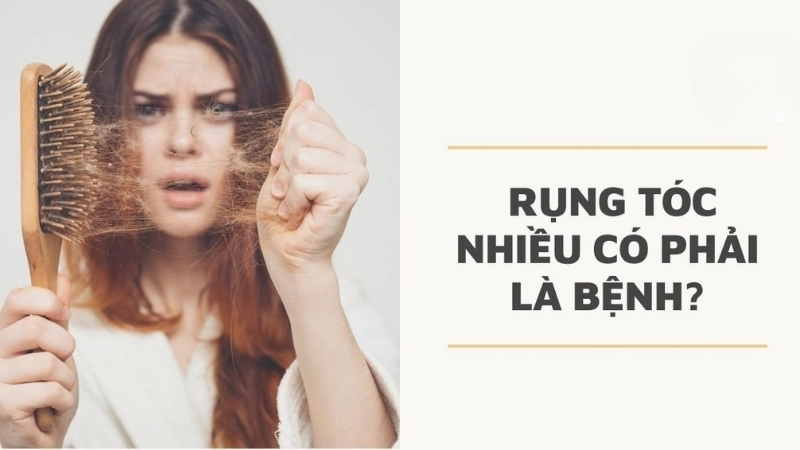 Rụng tóc nhiều có bị sao không?