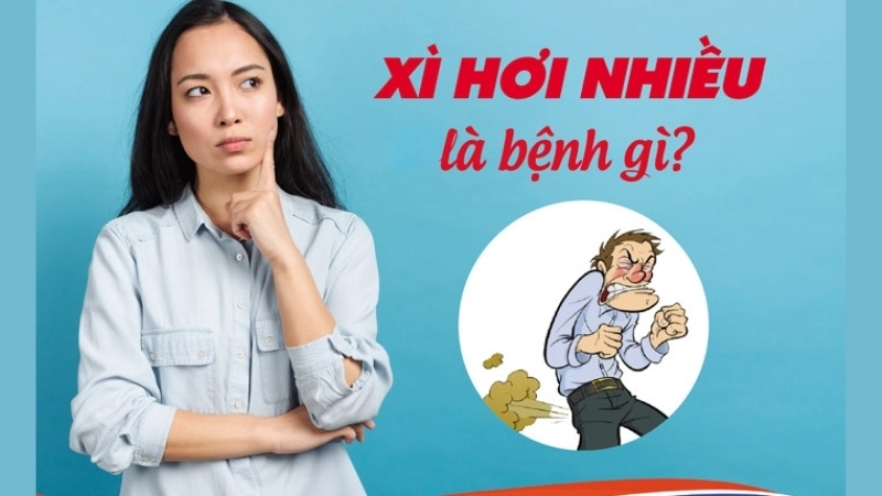 Phương pháp và mẹo chữa trị khi bị xì hơi nhiều