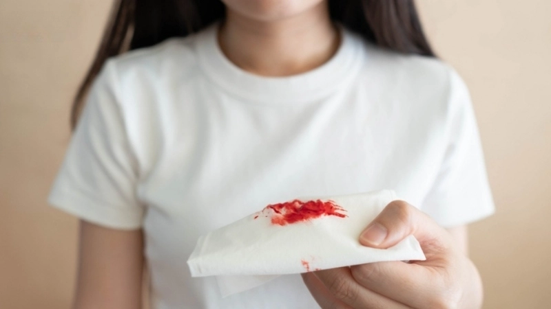 Phương pháp và mẹo chữa trị khi bị xì mũi ra máu