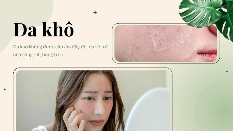 Da khô không được cấp ẩm đầy đủ, da sẽ trở nên căng rát, bong tróc