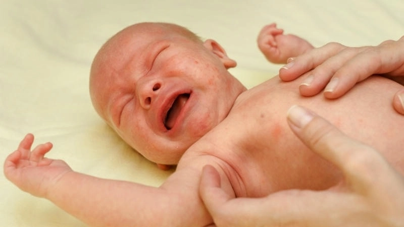 Sốt phát ban ở trẻ em thường kèm theo các nốt ban hồng nhỏ, không ngứa.