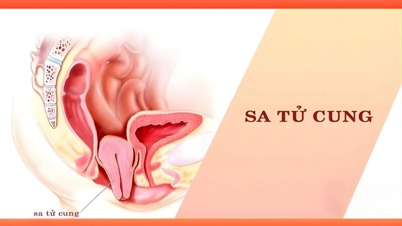 Khi nào cần gặp bác sĩ ngay sau khi tự kiểm tra?