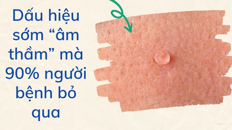 Dấu hiệu sớm “âm thầm” mà 90% người bệnh bỏ qua