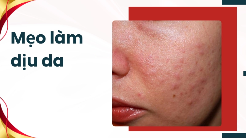 Mẹo làm dịu da tức thì khi có dấu hiệu phát ban, nổi mụn