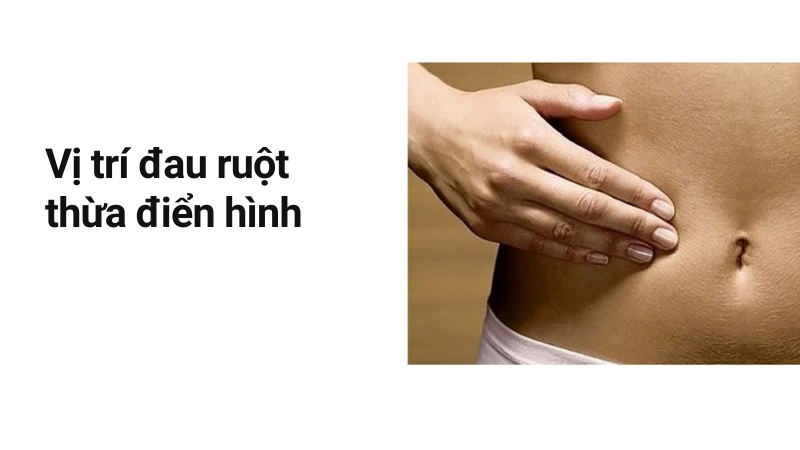 Vị trí cơn đau ruột thừa điển hình nhất